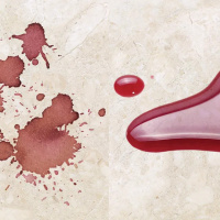 Пропитка защитная Tenax Proseal 1 л водо масло грязеотталкивающее для натурального и искусственного камня